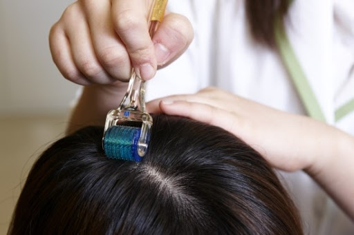 Derma Roller Treatment